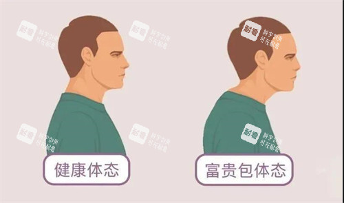 富贵包和健康体态对比动画图