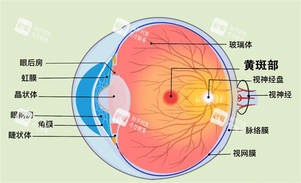 眼球黄斑病 眼球黄斑病