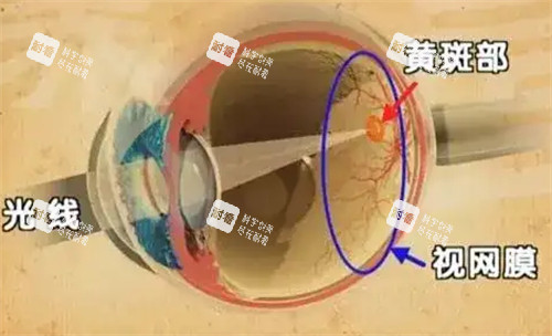 黄斑眼病的发病位置图解 黄斑眼病的发病位置图解