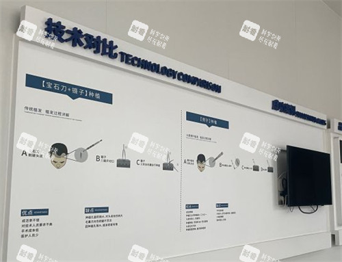 西安大麦植发技术对比墙