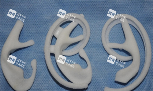 耳再造手术材料图 耳再造手术材料图