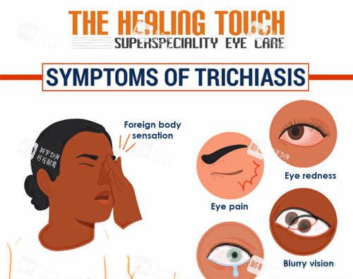 倒睫对眼睛的刺激 倒睫对眼睛的刺激