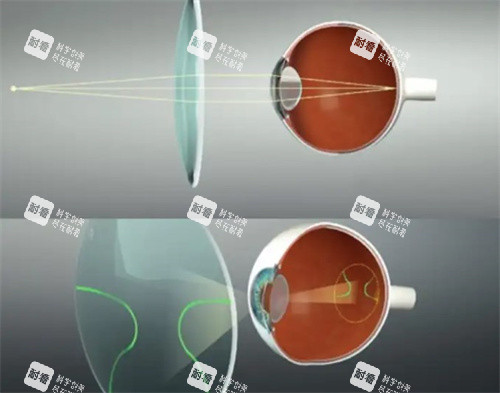 渐进镜片技术 渐进镜片技术