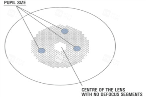 离焦镜片原理 离焦镜片原理