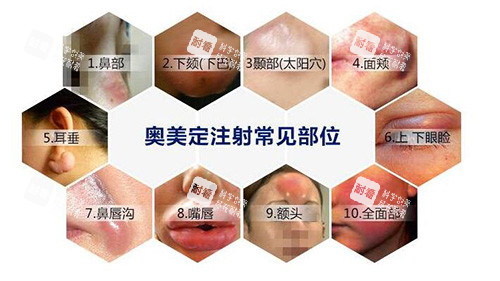 奥美定注射危害有哪些