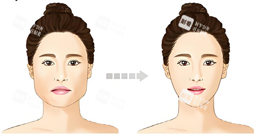 下巴宽大与正常下巴对比动画图 下巴宽大与正常下巴对比动画图