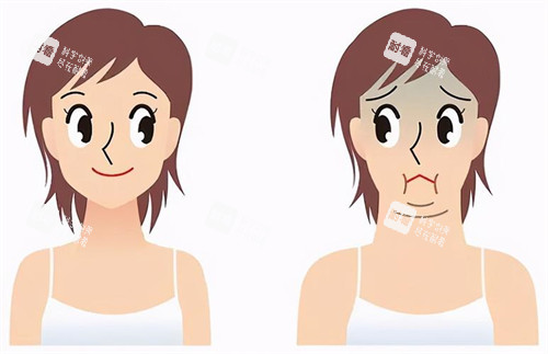 下巴宽大与正常对比动画图 下巴宽大与正常对比动画图