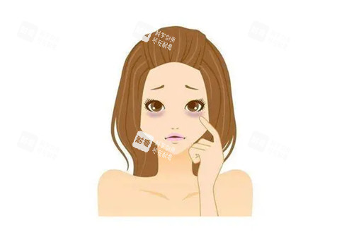 黑眼圈卡通示意图