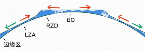 角膜塑形镜眼压变化