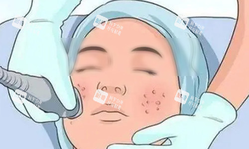 超声炮的操作动画示意图