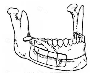 下颚动画示意图