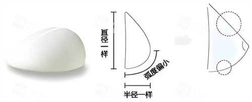 假体隆胸水滴形