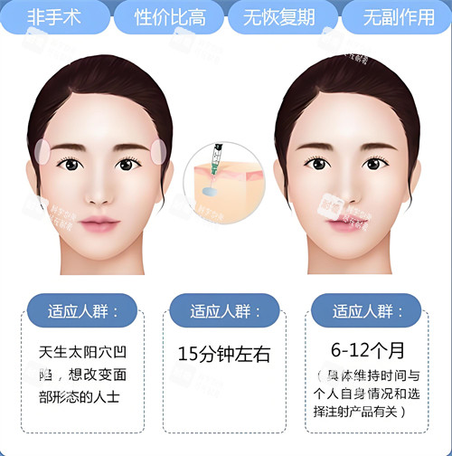 玻尿酸注射填充适合人群与原理动画图