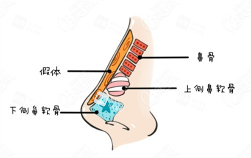 隆鼻动画解剖图 隆鼻动画解剖图