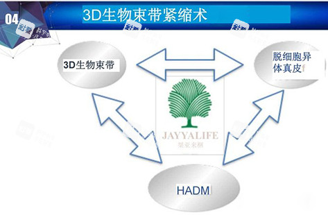 3d生物束带紧缩术讲解示意图