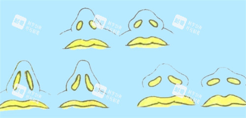 各种不同的鼻子