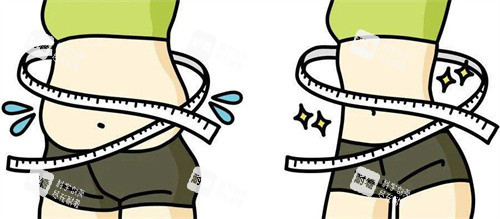 小蛮腰吸脂前后 小蛮腰吸脂前后