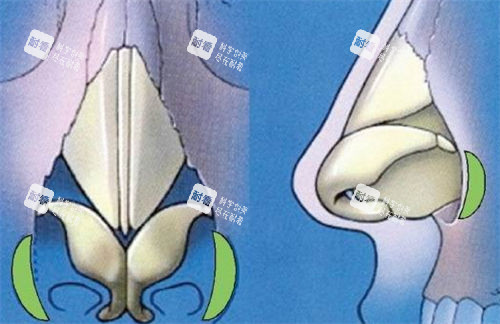 鼻部鼻背鼻头透视图 鼻部鼻背鼻头透视图