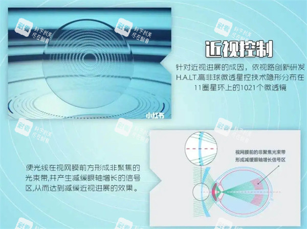 近视控制原理图解