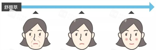 舒颜萃童颜针前后变化