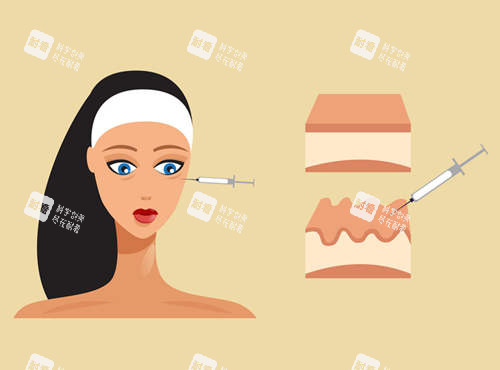 注射美容图示