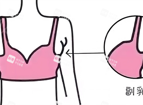 副乳展示动画图