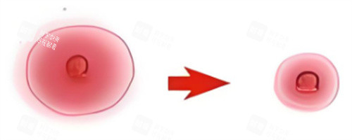 乳晕缩小对比图 乳晕缩小对比图