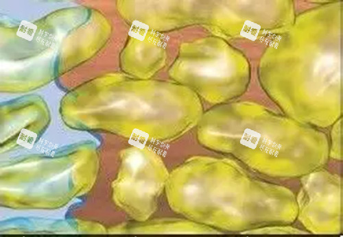 水动力吸脂微观示意图