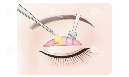 深圳济美仁医疗美容门诊部怎么样？超优质！眼鼻整形与皮肤抗衰双强项，个性化方案定制，变漂亮结果超预期