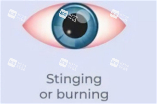 眼睛刺痛或燃烧