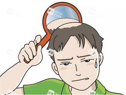 脂溢性脱发造成的困扰
