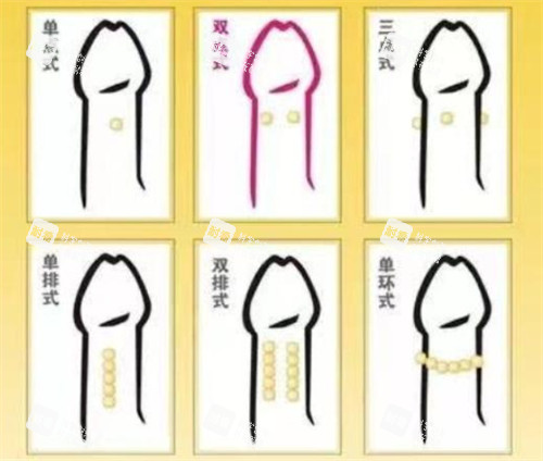 阴茎入珠术款式