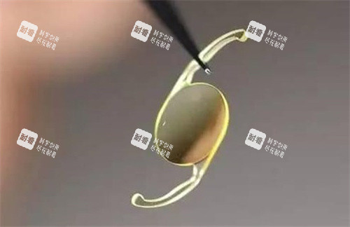 北京同仁眼科医院联系电话是多少?010-58269911是医院的客服电话可以直接预约！