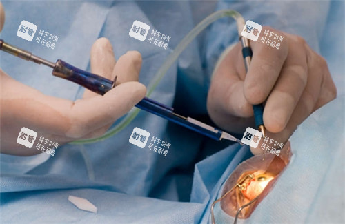 眼手术操作图 眼手术操作图