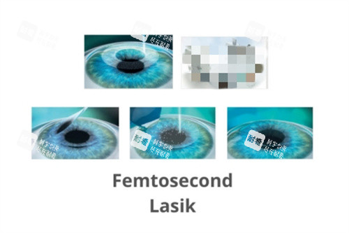 贵阳康视眼科正规吗？超合规！备案资质全，医师团队可靠，诊疗操作规范，看眼安心选