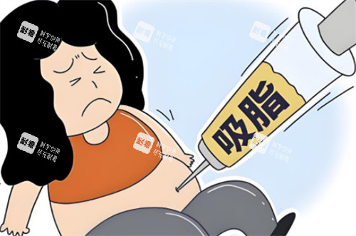 非正规吸脂术 非正规吸脂术