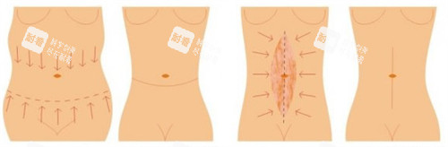 不同程度的腰腹 不同程度的腰腹