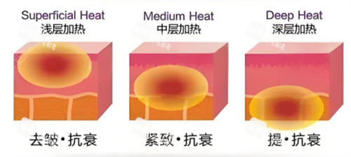 热拉提分层作用