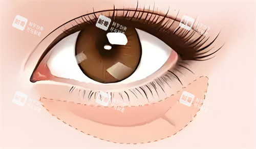 眼袋的位置卡通图