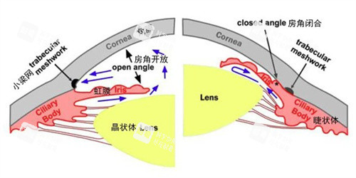 青光眼和正常眼睛的对比 青光眼和正常眼睛的对比