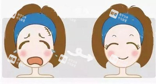 激光美容前后对比卡通示意图