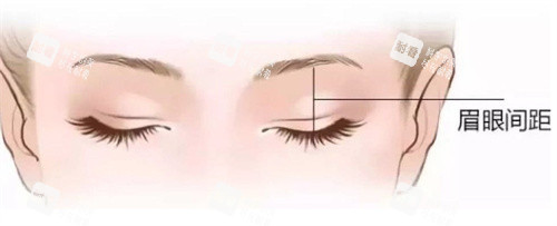 双眼皮术前设计 双眼皮术前设计