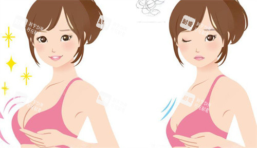 隆胸手术前后对比卡通图