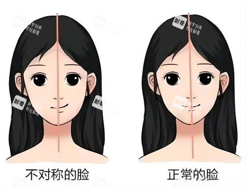 面部不对称与正常的脸对比动画图