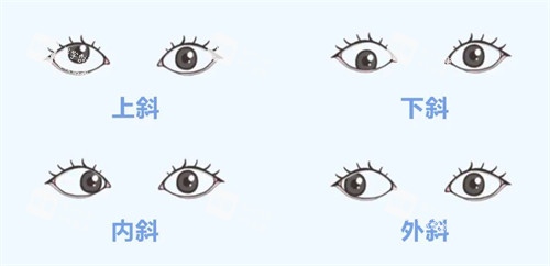 上斜下斜内斜外斜的区别
