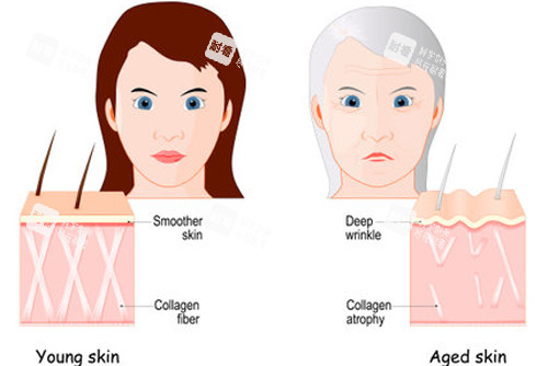不同年龄段皮肤组织的区别图解