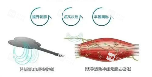 emface 美菲斯功效