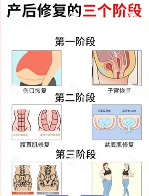 产后修复的三个阶段