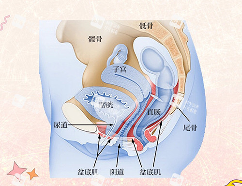 盆底肌修复漫画示意图