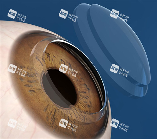 角膜移植手术动画图 角膜移植手术动画图